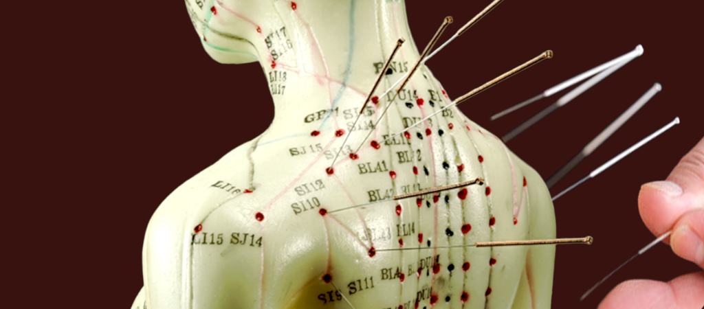 acupuncture cape town